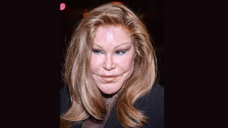 Abschied von Jocelyn Wildenstein: Die High-Society-Ikone stirbt in Paris