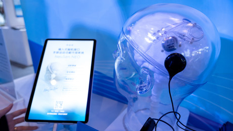Chinas Gehirn-Implantat-Revolution: Start-up stiehlt Elon Musk die Show