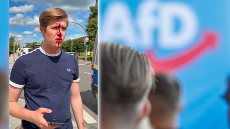 Blutiger Angriff in Schwerin: AfD-Jugendchef bei Antifa-Demo niedergestreckt!